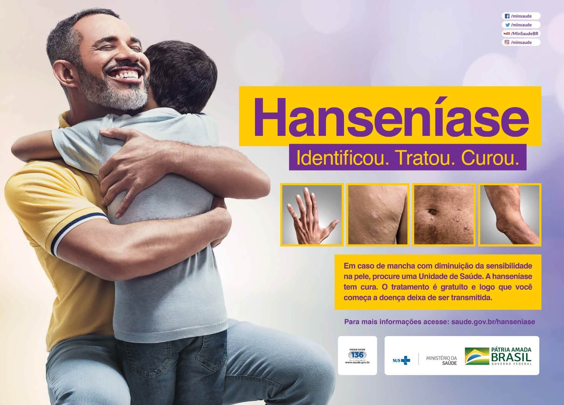 O que preciso saber sobre a hanseníase? - PartMed - A maior rede