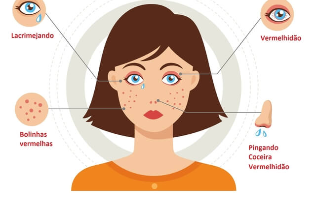 Xarope para tosse alérgica: 6 opções para aliviar o sintoma - Minha Vida